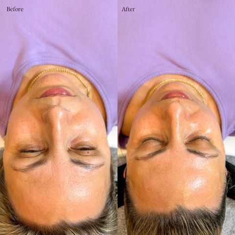 Radiant Skin Treatment